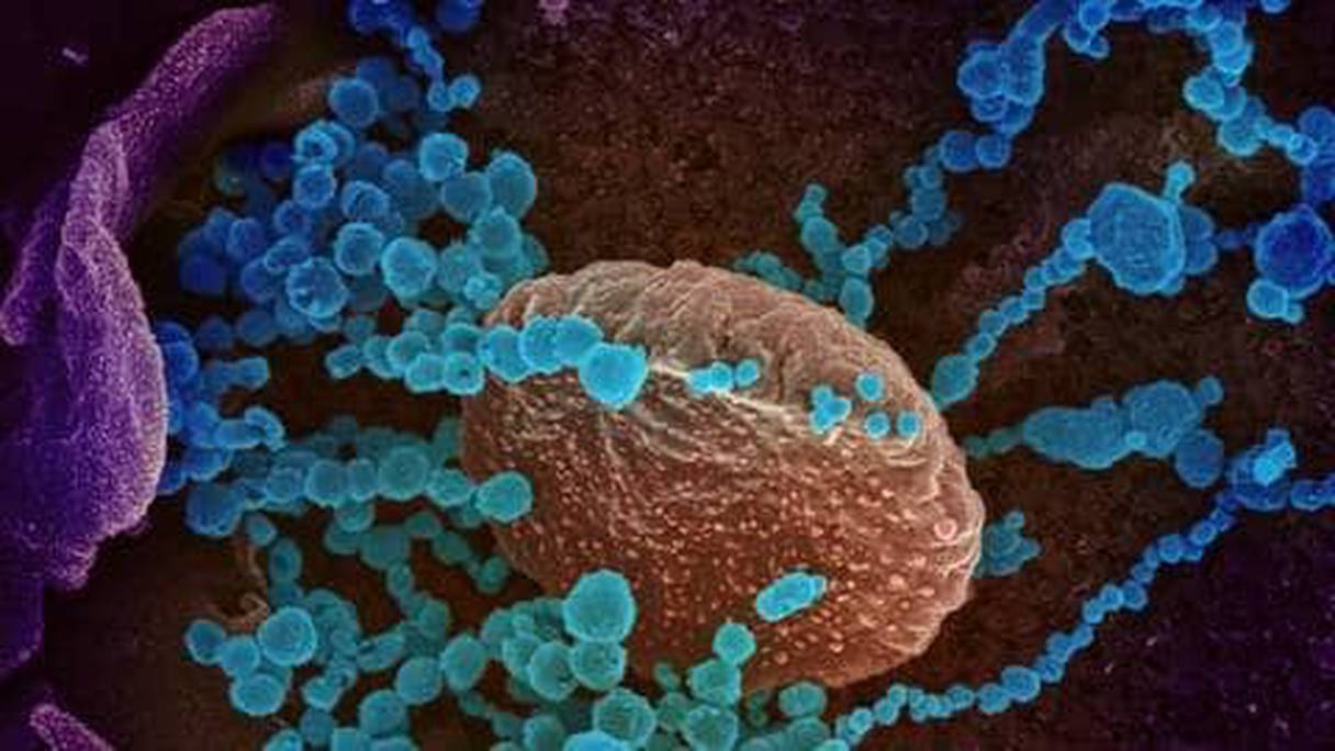 Le virus Sars-CoV-2 vu au microscope électronique. Le coronavirus apparaît en bleu à la surface d'une cellule cultivée en laboratoire. 
