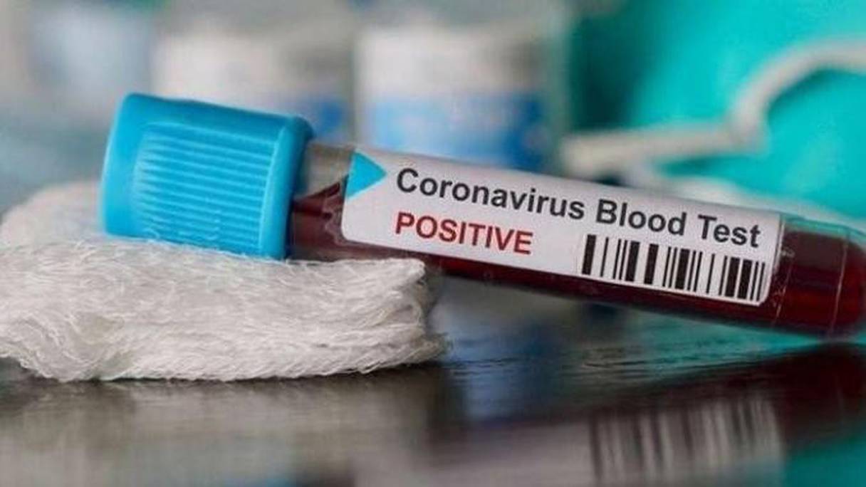 Test sanguin positif à la covid-19.
