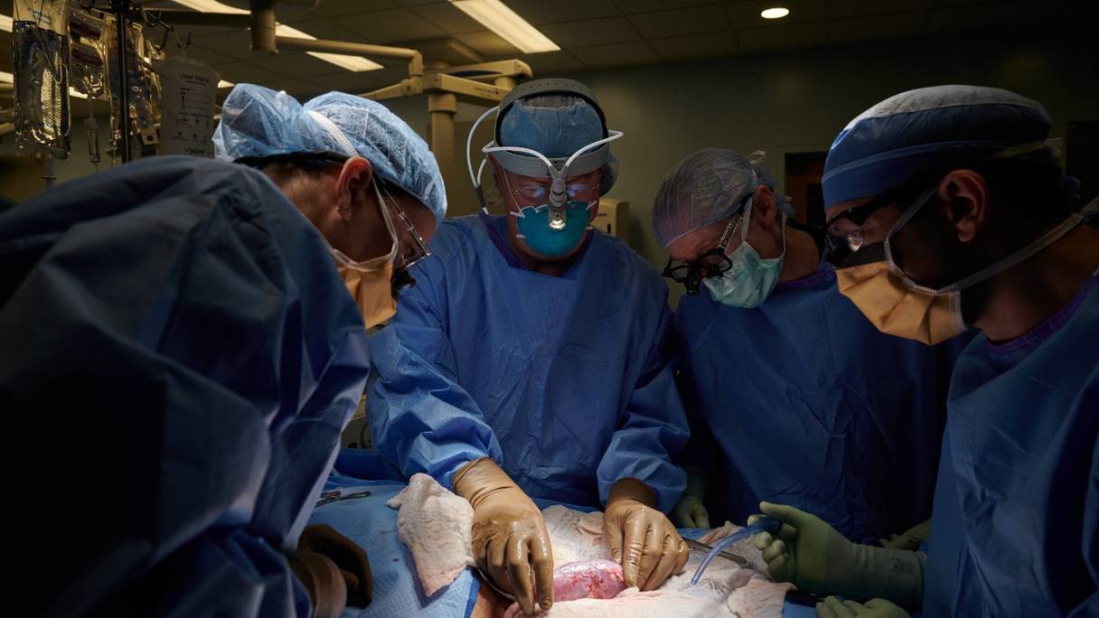 L'équipe chirurgicale examine un rein de porc génétiquement modifié à la recherche de signes de rejet, le 25 septembre 2021, au NYU Langone Health.
