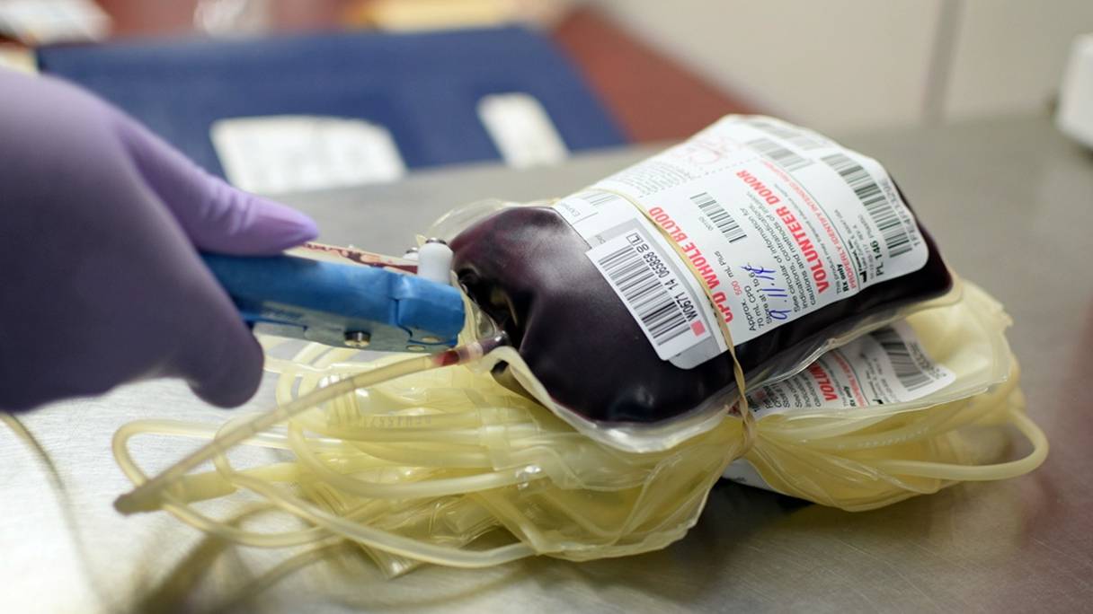 Une poche de sang étiquetée, pour une transfusion sanguine. Les enfants atteints de thalassémie ont besoin d'une transfusion sanguine tous les mois. 
