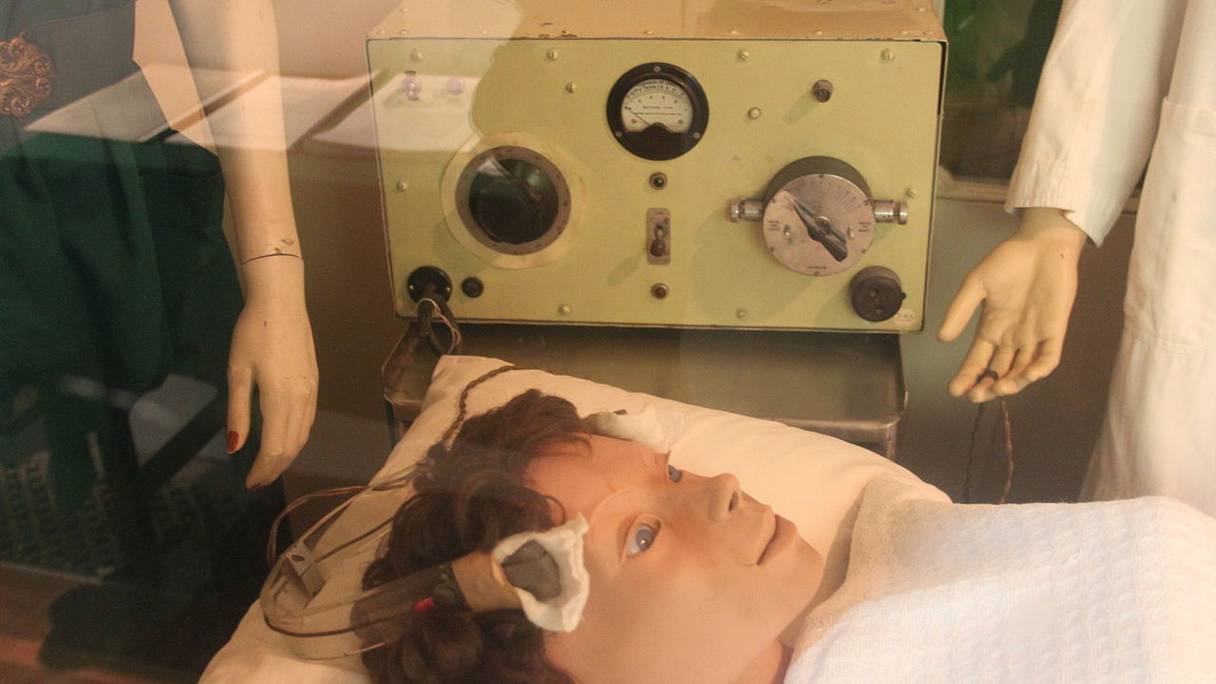 Un ancien appareil de thérapie par électrochocs exposé au Glenside Museum, à Bristol, en Grande-Bretagne, le 21 juillet 2014.
