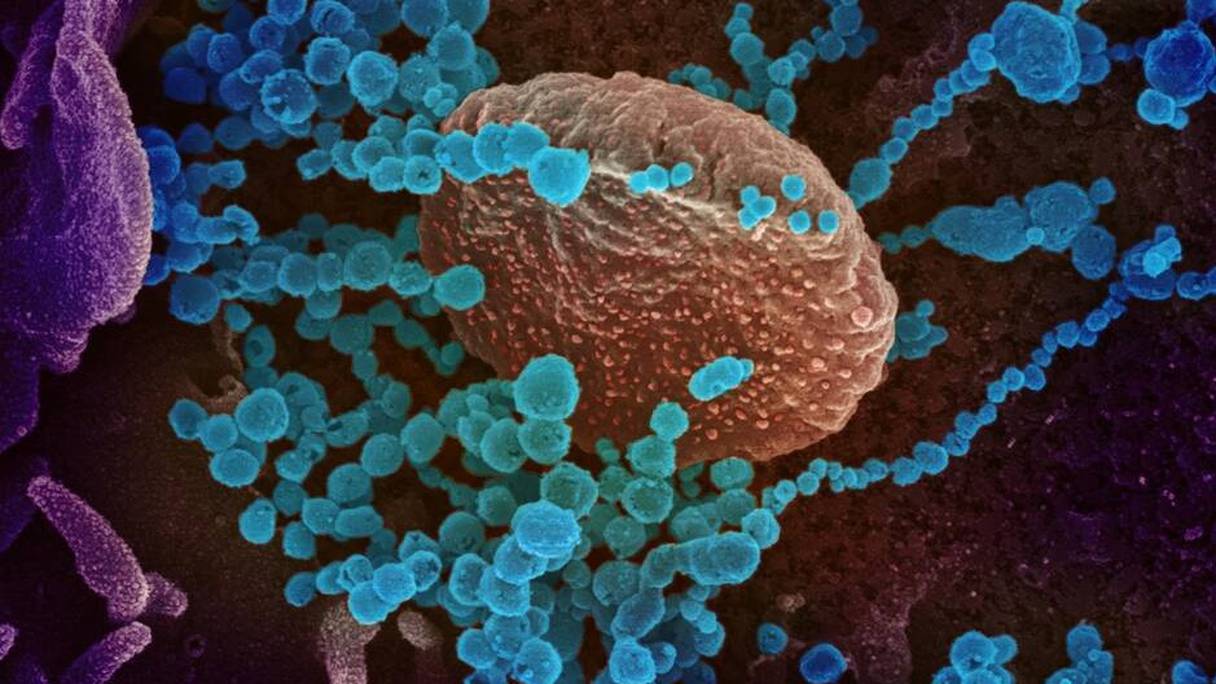 Le coronavirus SARS-CoV-2, au microscope électronique, apparaît en bleu sur une cellule cultivée en laboratoire. 
