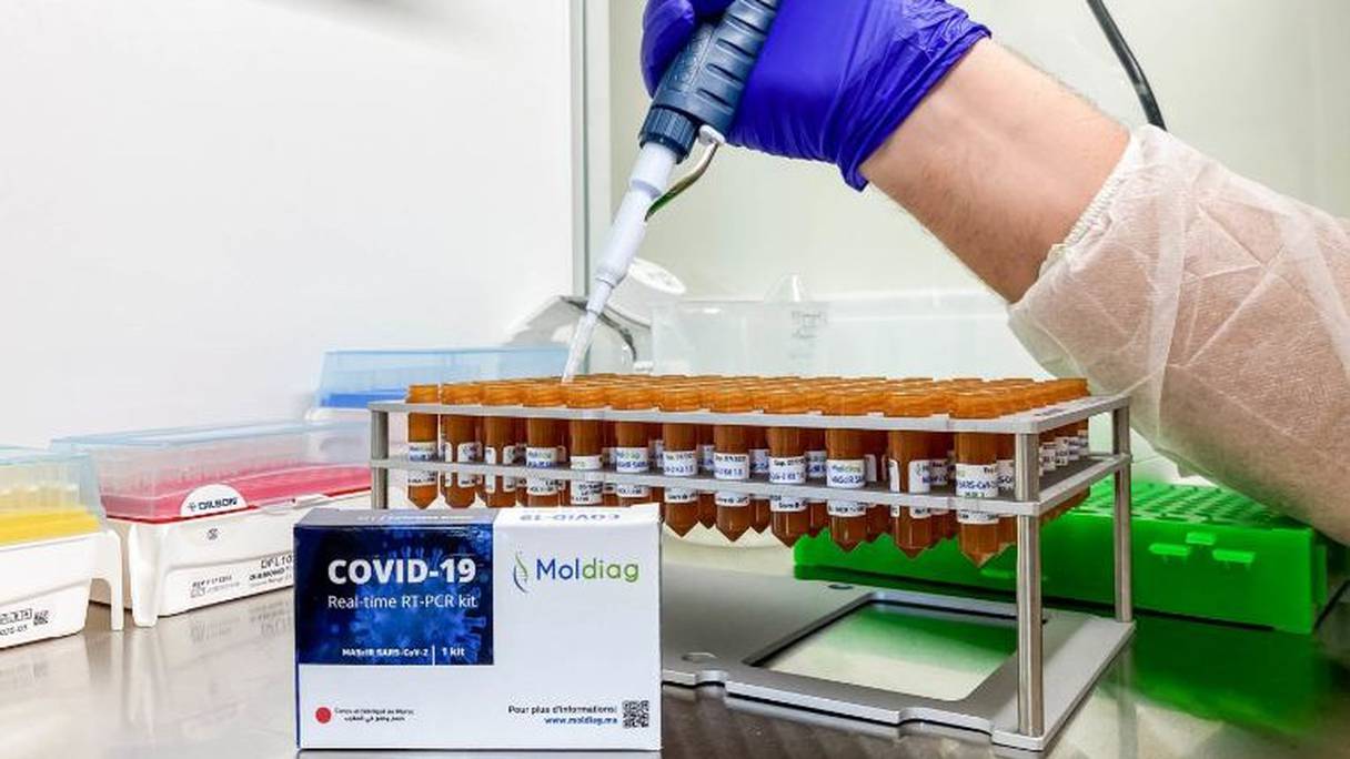 Moldiag peut désormais produire et commercialiser son kit, avec une capacité de production de 1 million de tests de diagnostic par mois.
