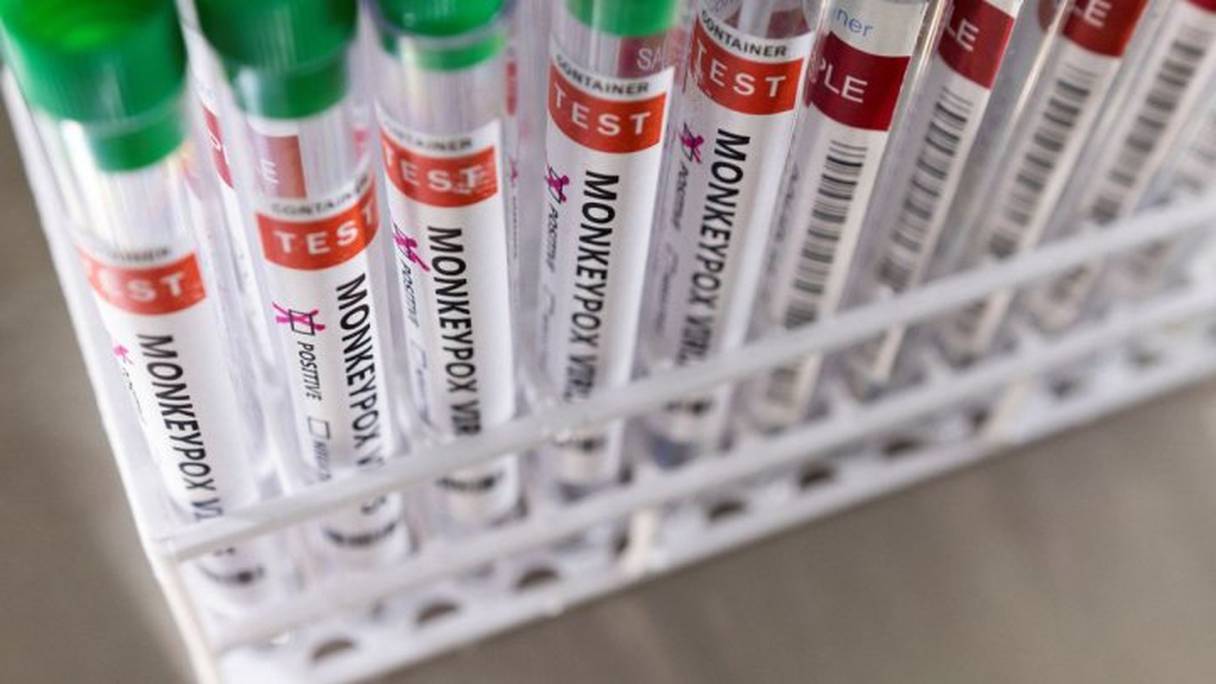 Des tests positifs à la variole du singe, le 22 mai 2022. 
