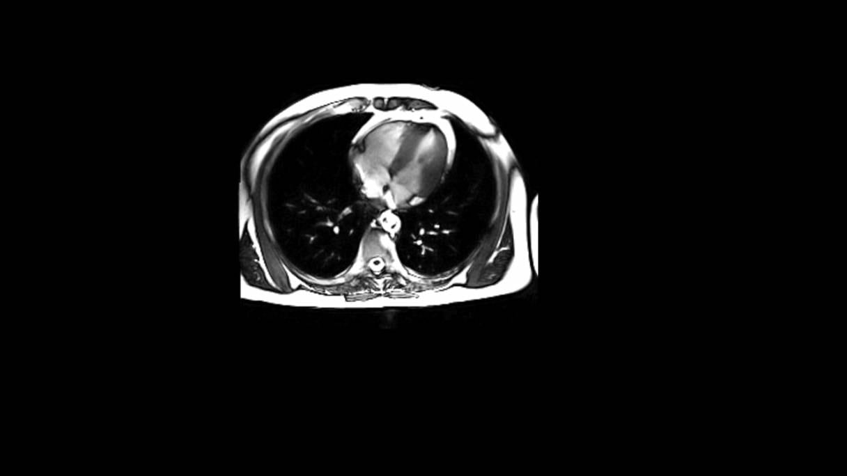 Pulsation d'un cœur, image obtenue avec un scanner IRM 3T.
