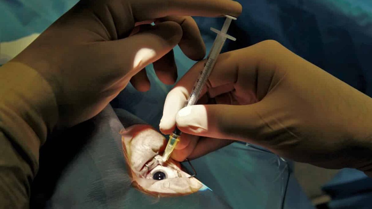 Une injection intravitréenne.