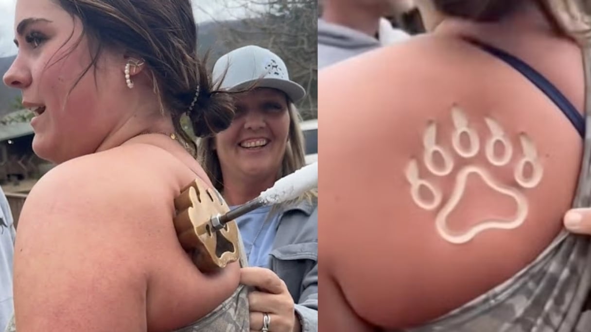 Les dermatologues mettent en garde contre les dangers du Freeze Branding, technique de marquage du bétail utilisée comme nouvelle technique de tatouage.