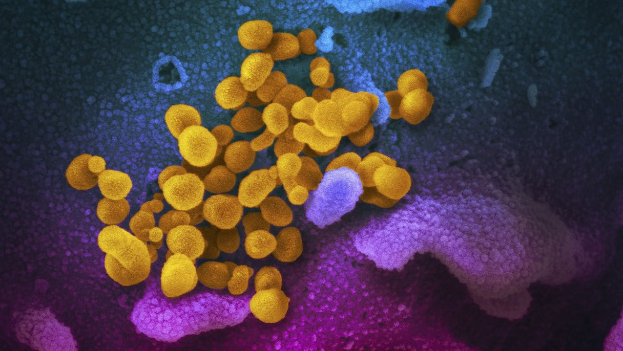 En jaune, le SARS-COV-2 vu au microscope. 
