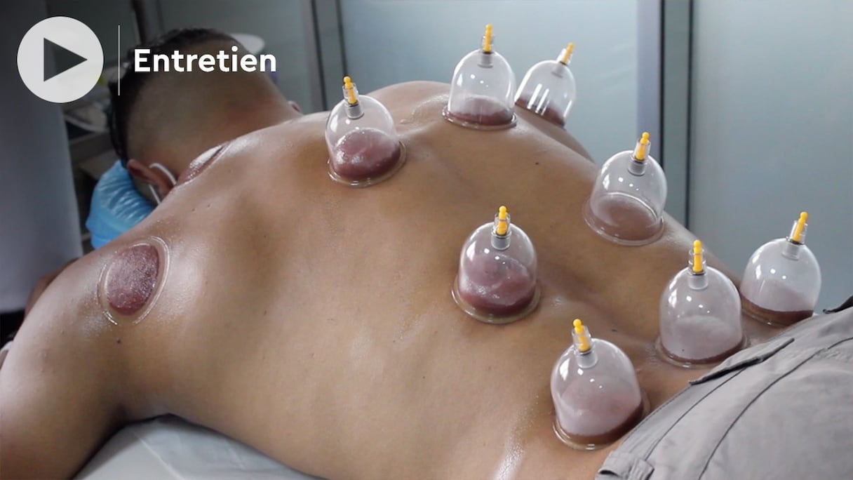 En «Cupping Therapy», ou «Hijama», des ventouses sont aujourd'hui appliquées dans des zones précises du dos, et des incisions y sont pratiquées, pour aspirer du sang et soulager ainsi les maux de patients. 
