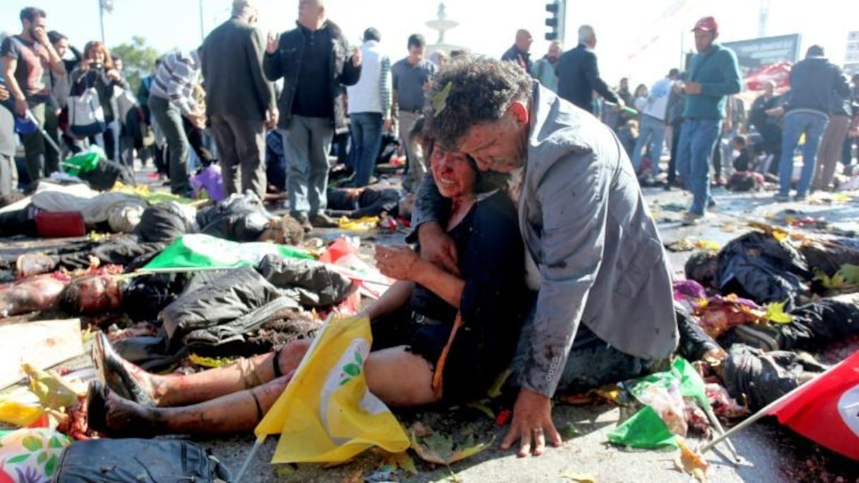 Une femme blessée dans les attentats du 10 octobre 2015 à Ankara.
