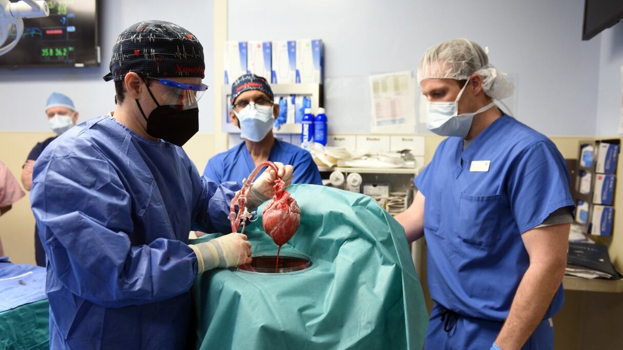 Des chirurgiens effectuent une greffe du cœur d'un porc génétiquement modifié au patient David Bennett, à Baltimore, dans le Maryland, le 7 janvier 2022.
