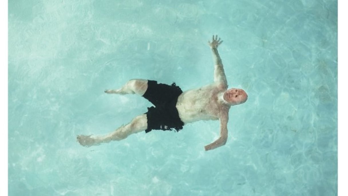 12 juin 2013, Bobby Henline, vétéran de la guerre d'Irak, est pris en photo dans la piscine d'un motel de Huston. Après avoir survécu à une explosition qui lui a causé des brûlures sur 38% du corps, Henline entame une carrière d'humoriste où il rit de ses blessures.
