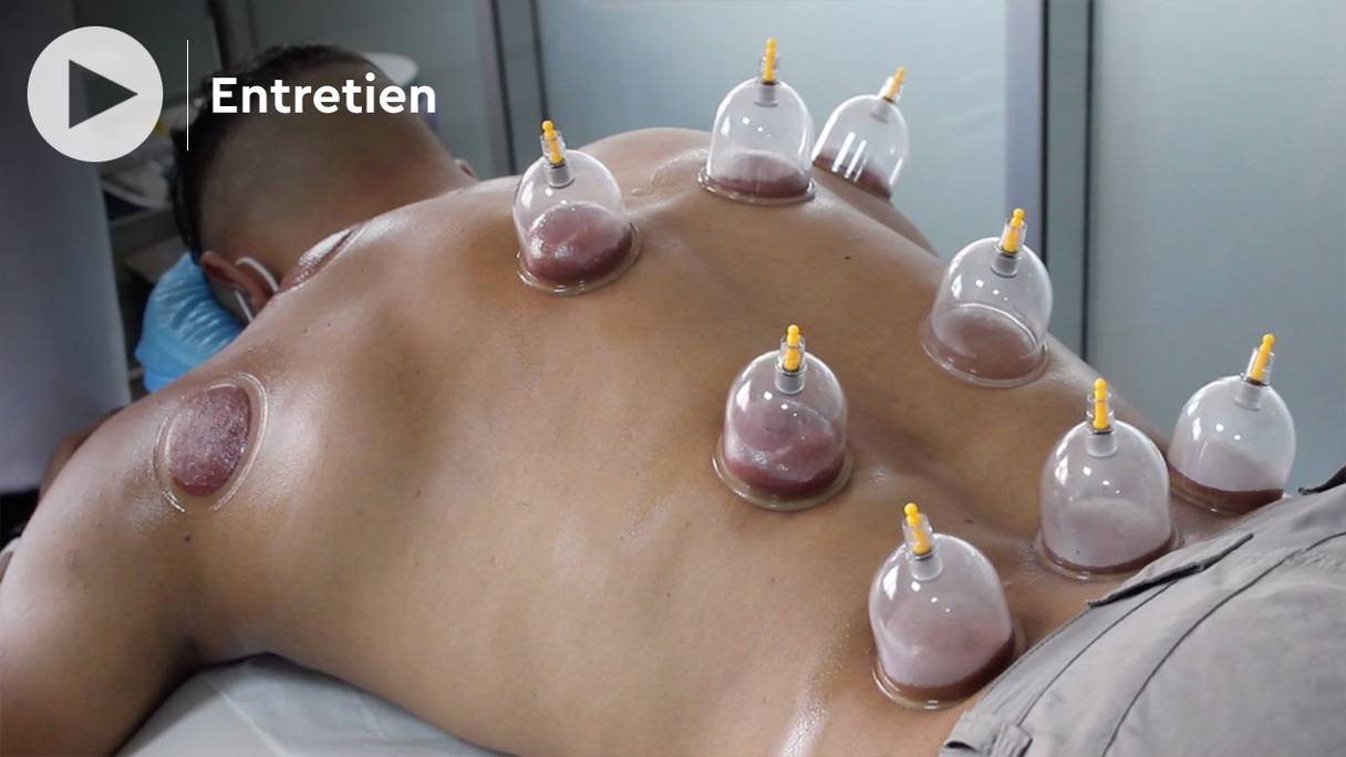 En «Cupping Therapy», ou «Hijama», des ventouses sont aujourd'hui appliquées dans des zones précises du dos, et des incisions y sont pratiquées, pour aspirer du sang et soulager ainsi les maux de patients. 
